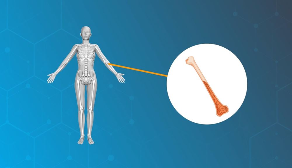 Bone Marrow Transplant
