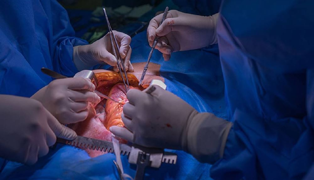 Heart Transplant