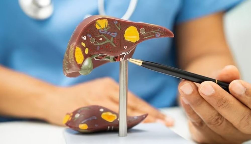 Liver Transplant